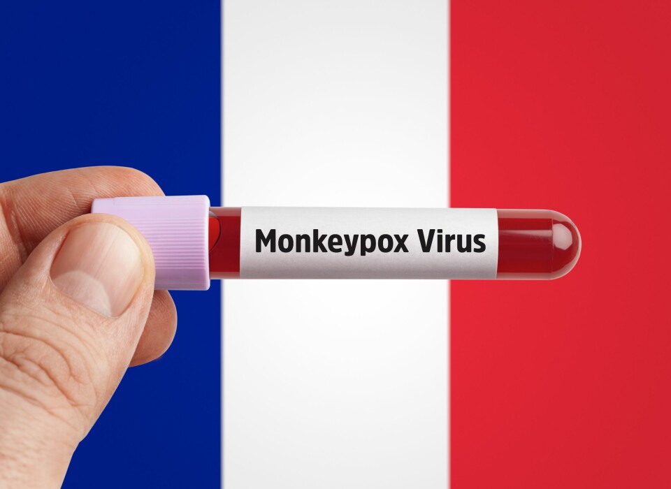 A test tube of blood labelled with “monkeypox” with a French flag background