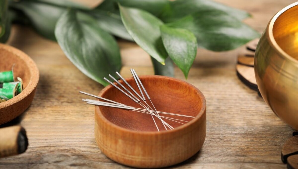Are acupuncture visits reimbursed in France? Are acupuncture visits reimbursed in France?