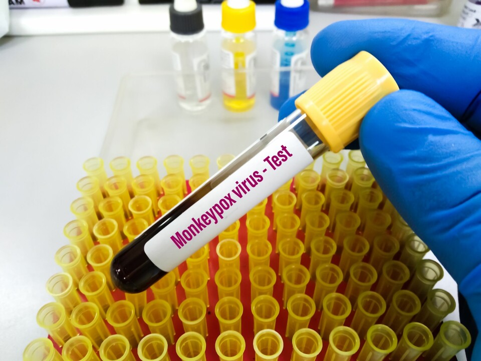 Blood sample in a lab test tube labelled Monkeypox virus test