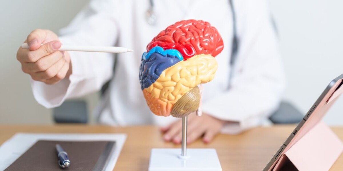 Why speaking french is good for your brain