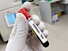 Cadmium tests can now be refunded in France: who is eligible?